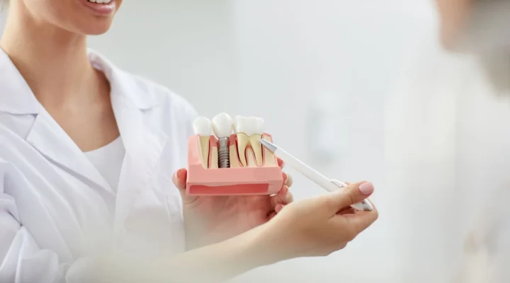 Daily hygiene with dental implants