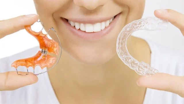 differences between clear and lingual braces