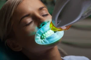 how long does professional teeth whitening last